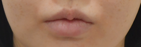 %25EC%258B%259C%25EC%2588%25A0%2B%25EC%25A0%2584.png
